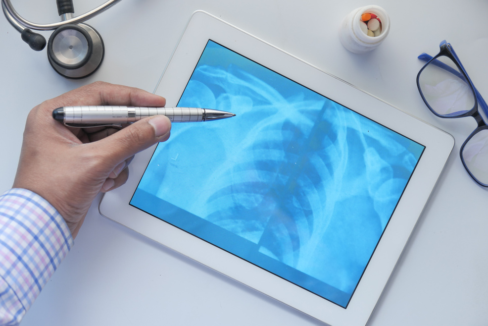 Male Doctor Hold Analyzing Xray Photography on Digital Tablet Closeup